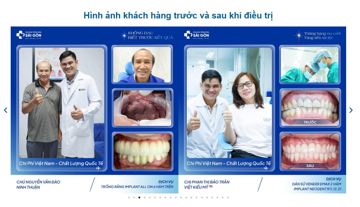 Hình ảnh khách hàng điều trị tại Nha Khoa Trồng Răng Sài Gòn